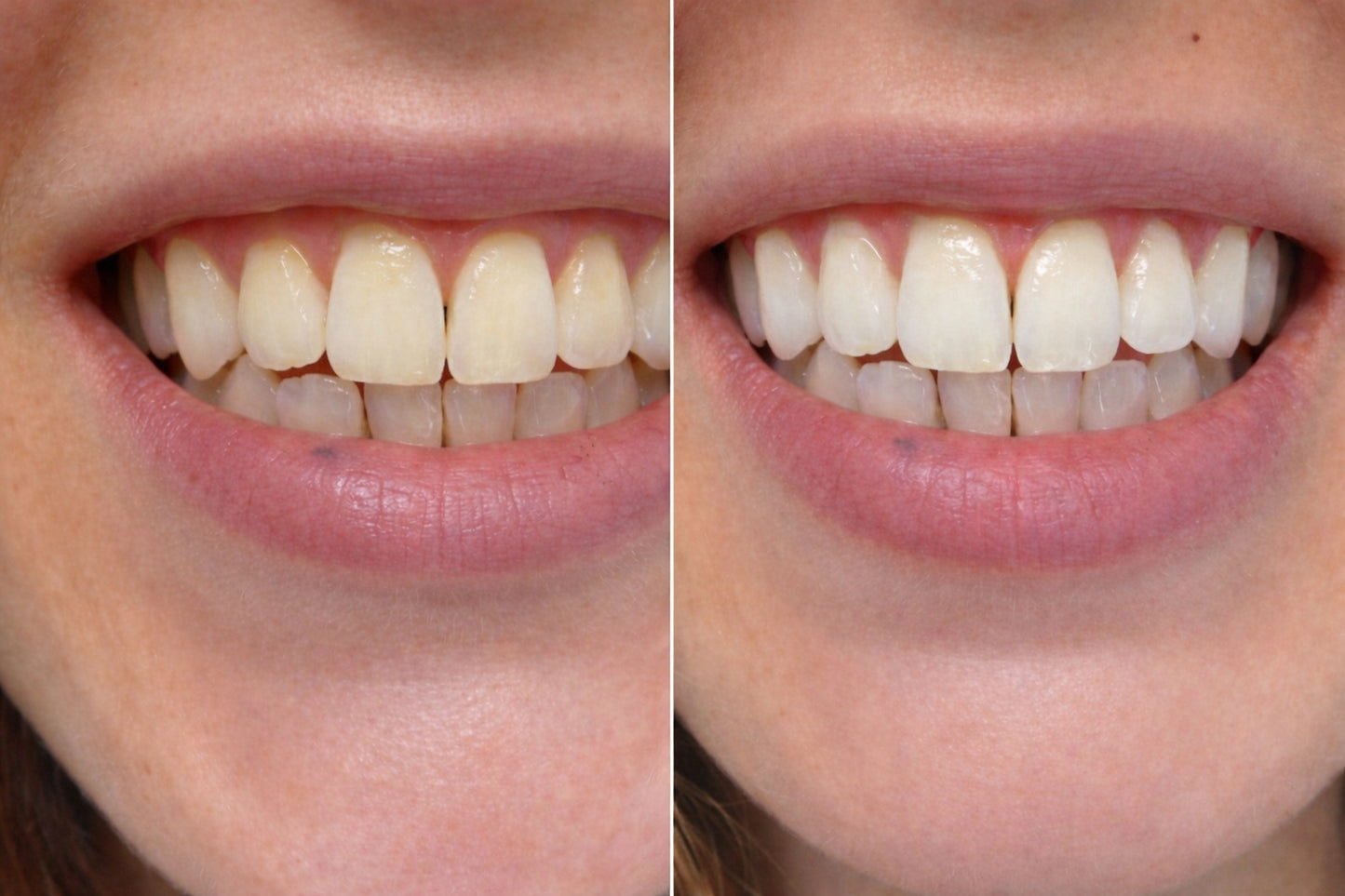 Whitening Wonder Toothpaste